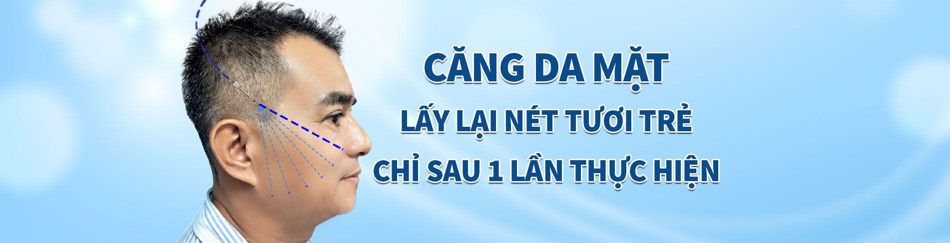 Căng Da Mặt – Lấy lại nét tươi trẻ chỉ sau 1 lần thực hiện