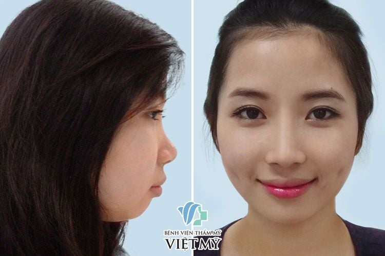 Nâng cằm, phẫu thuật cắt mắt, nâng mũi, thon gọn mặt, tạo hình môi.