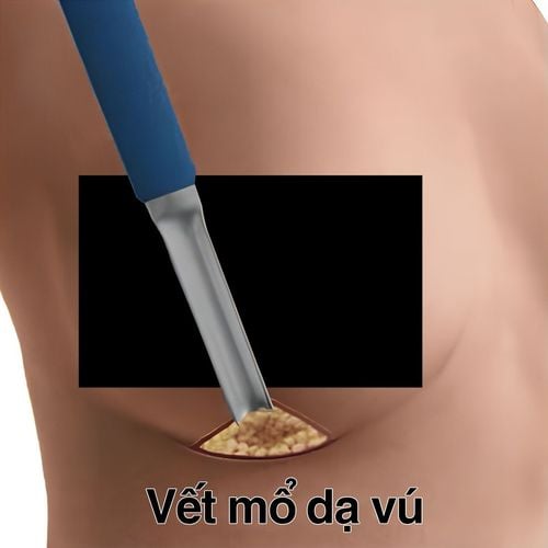 Slide item